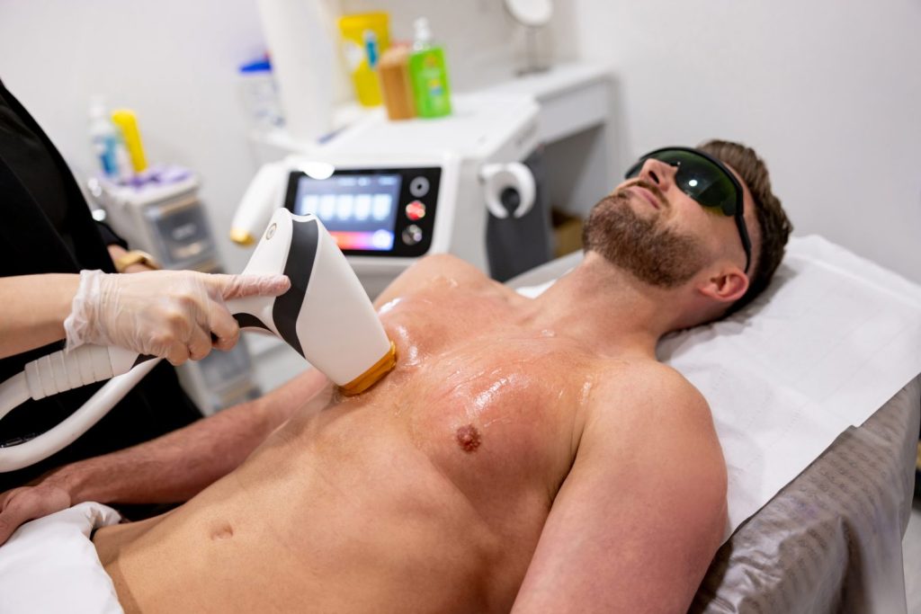 Laser Hair removal London