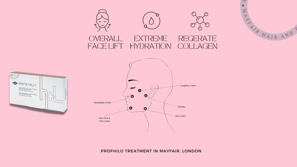 PROFHILO treatment in mayfair, london
