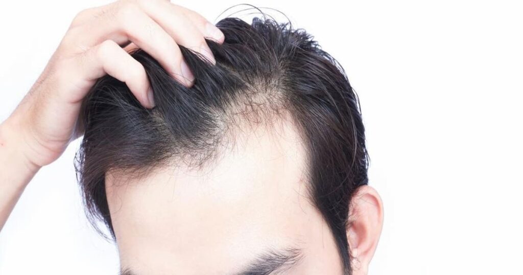 Effective Scalp Treatments