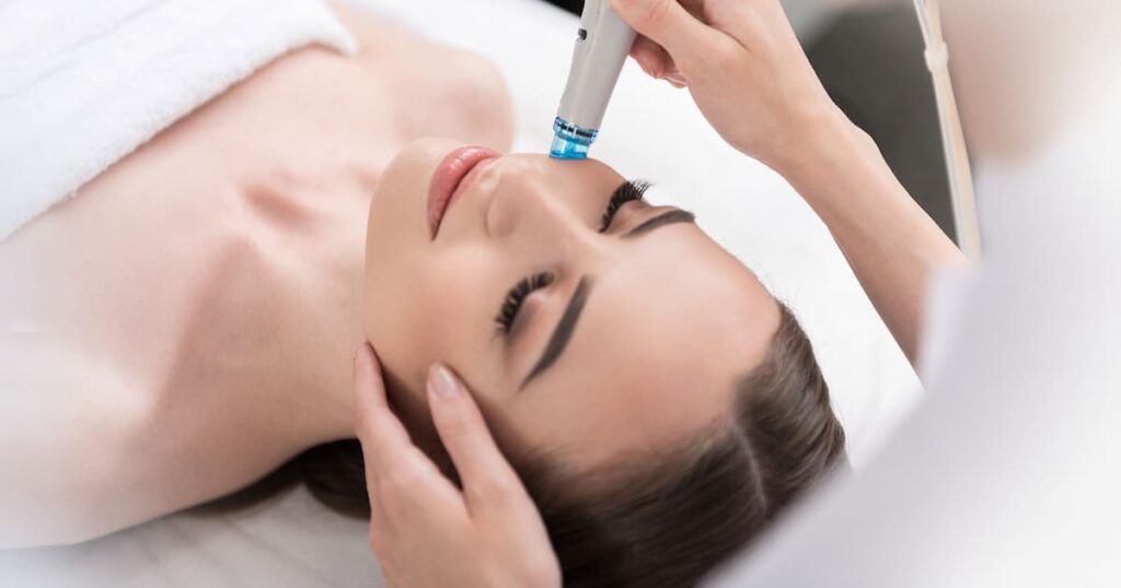 Microneedling-facial-traetments