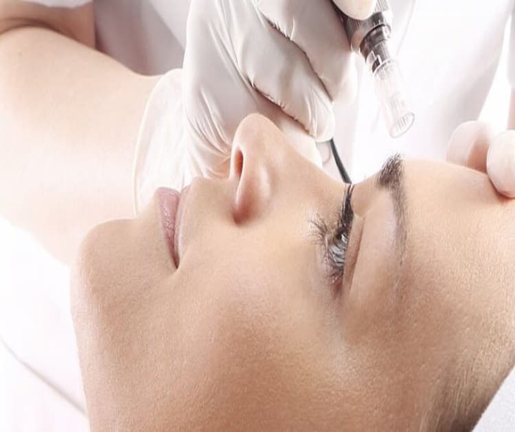 Skin Rejuvenation microneedling