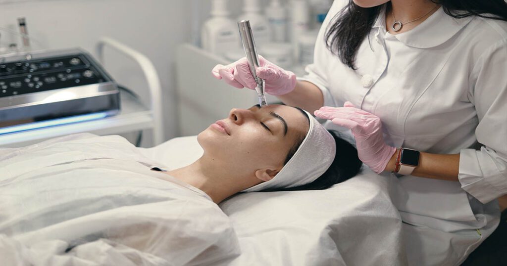 The Microneedling Procedure