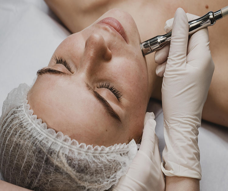 What Is Microneedling?