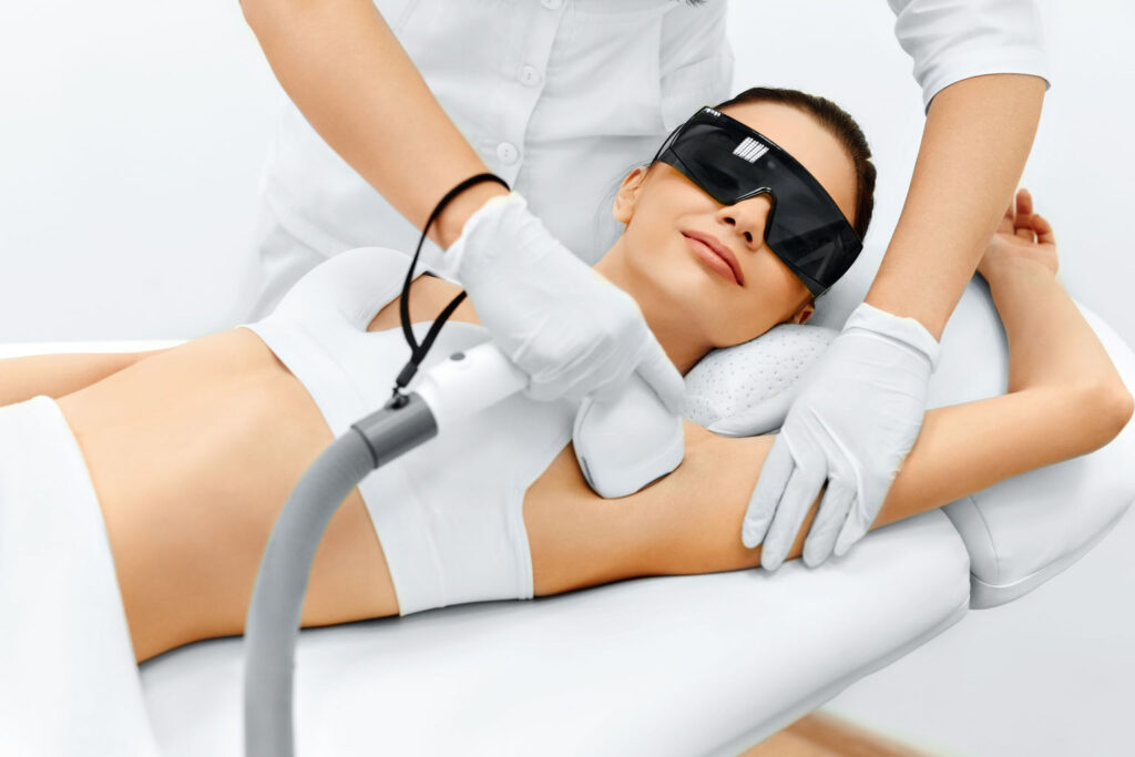 laser-hair-removal-Kensington