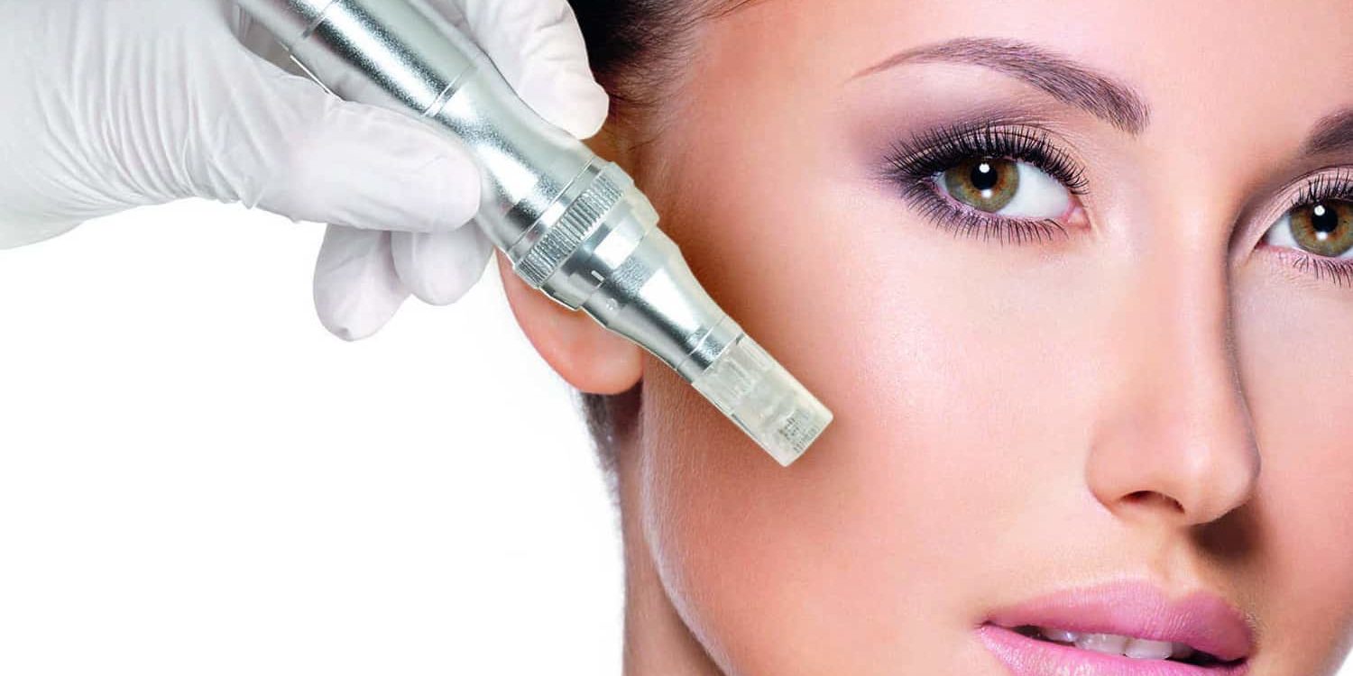 Microneedling in Mayfair