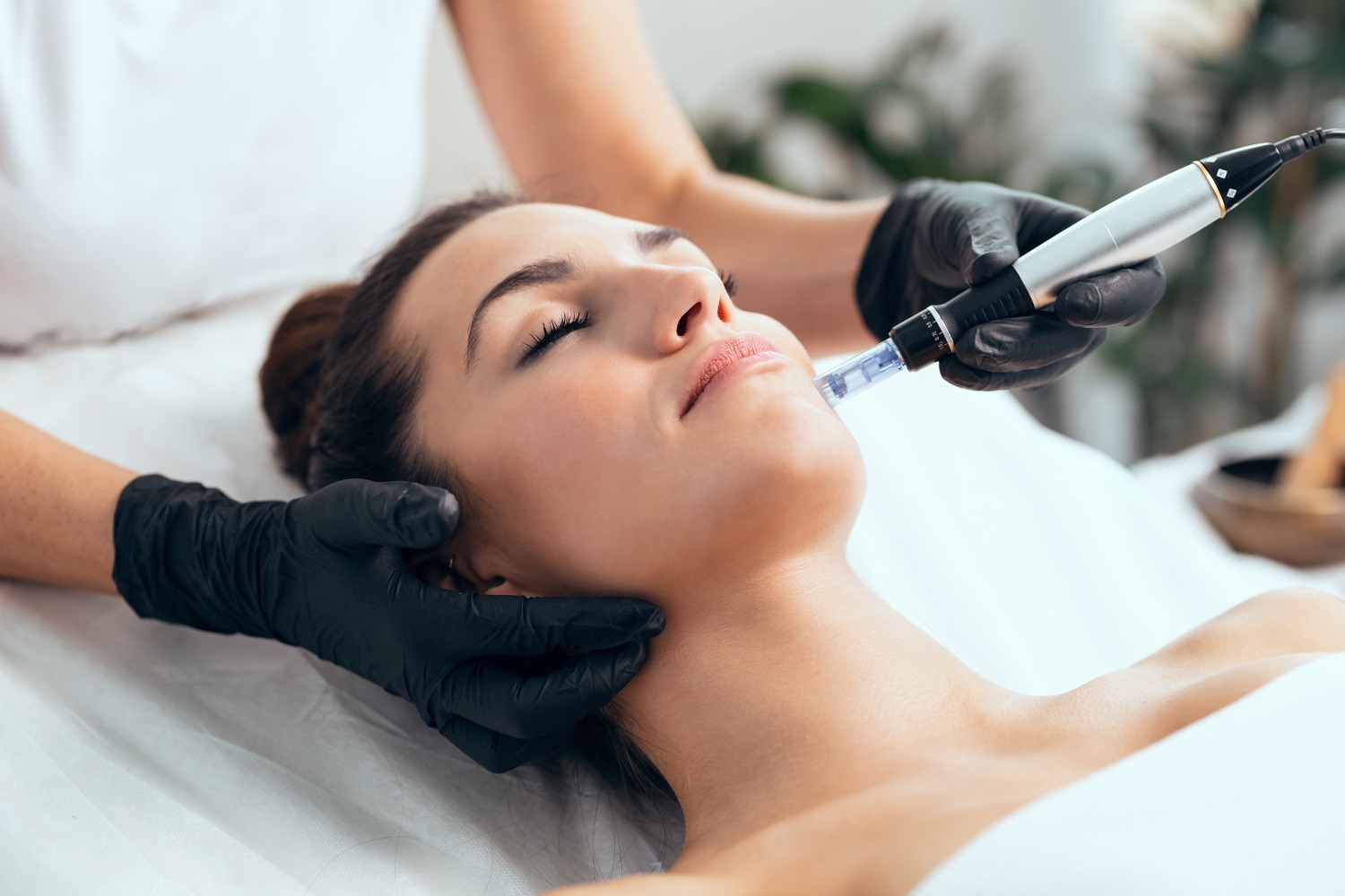 Microneedling in Mayfair