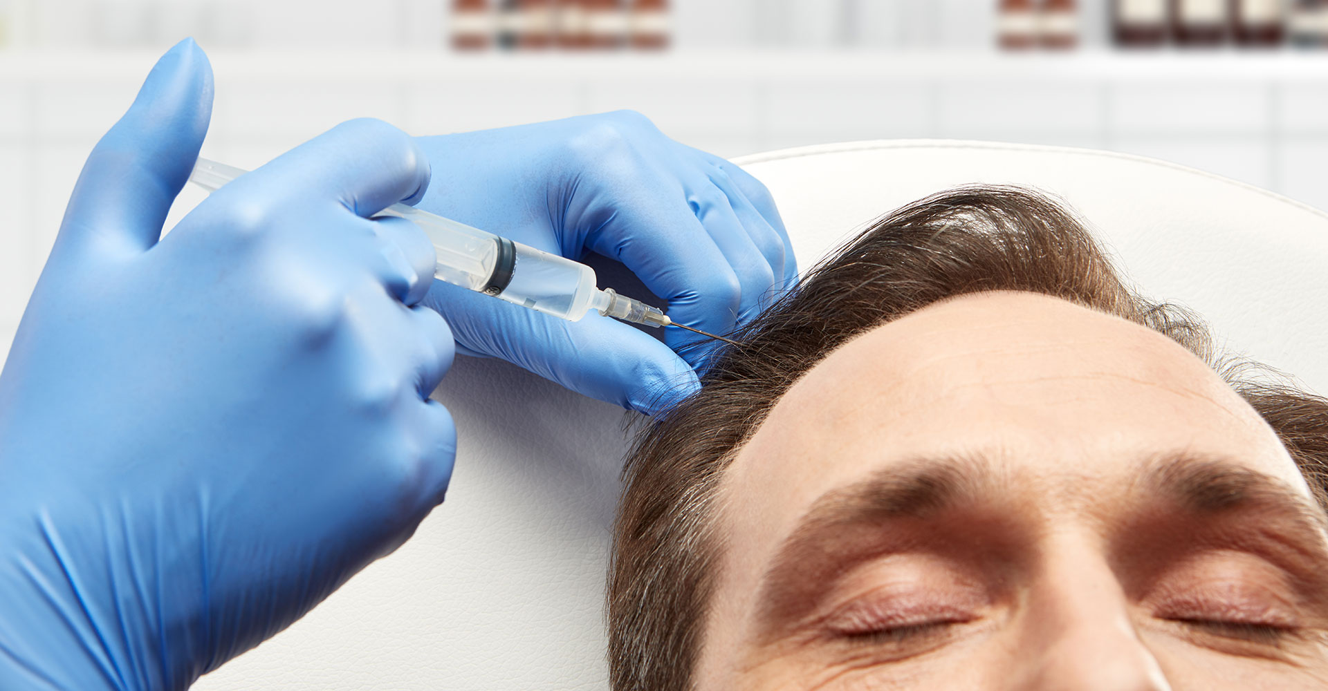 PRP Hair Treatment in Mayfair