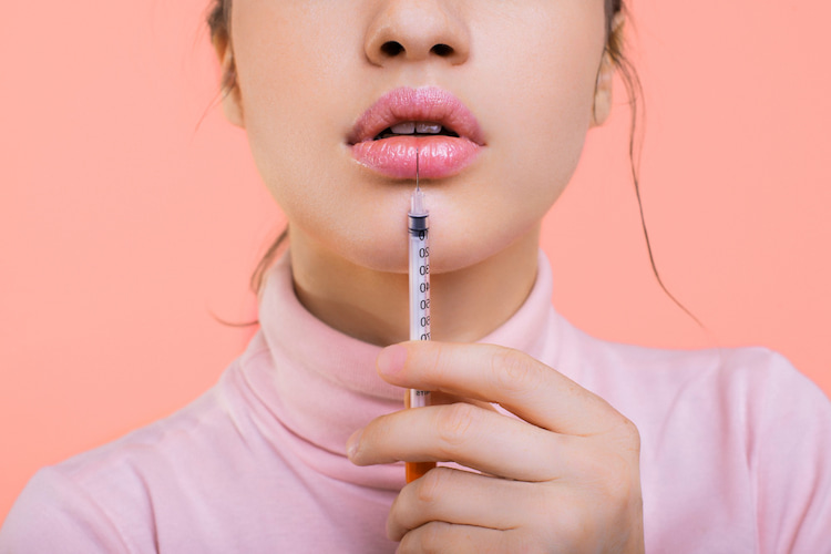 What is Cannula Lip Filler?