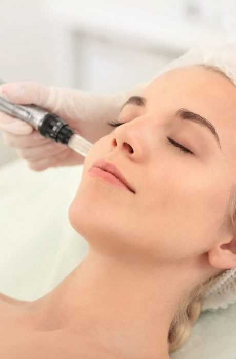 Microneedling in London