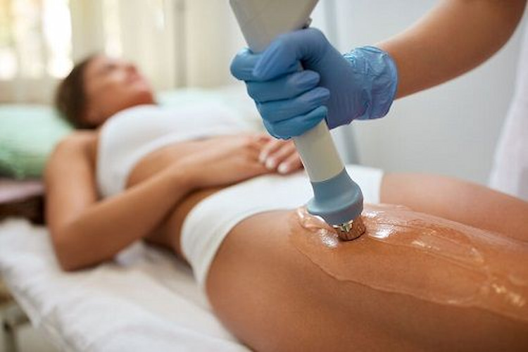 Cellulite treatments