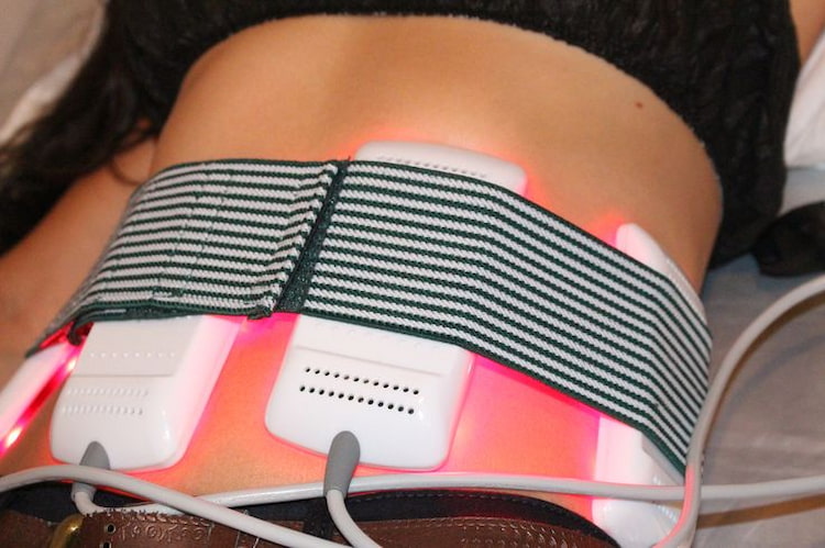 laser lipo